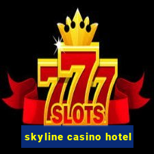 skyline casino hotel